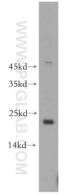 Western Blot (WB) analysis of HeLa cells using POLR1D Polyclonal antibody (12254-1-AP)