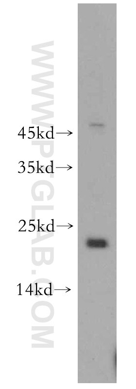 Western Blot (WB) analysis of HeLa cells using POLR1D Polyclonal antibody (12254-1-AP)