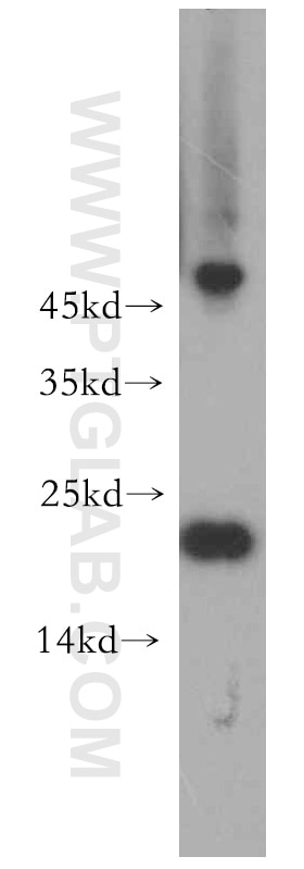 Western Blot (WB) analysis of Jurkat cells using POLR1D Polyclonal antibody (12254-1-AP)