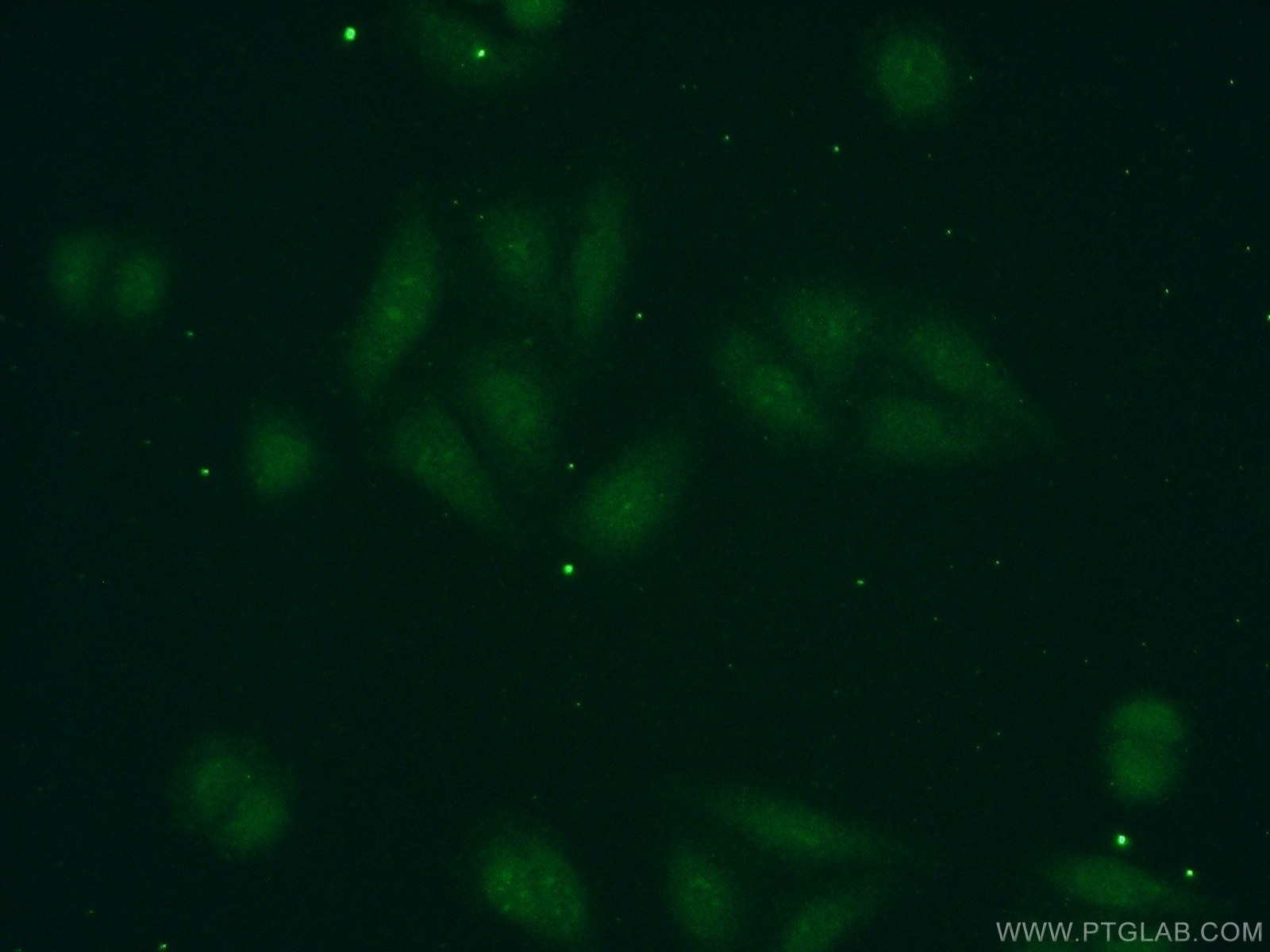 Immunofluorescence (IF) / fluorescent staining of HepG2 cells using POLR1D Polyclonal antibody (16678-1-AP)