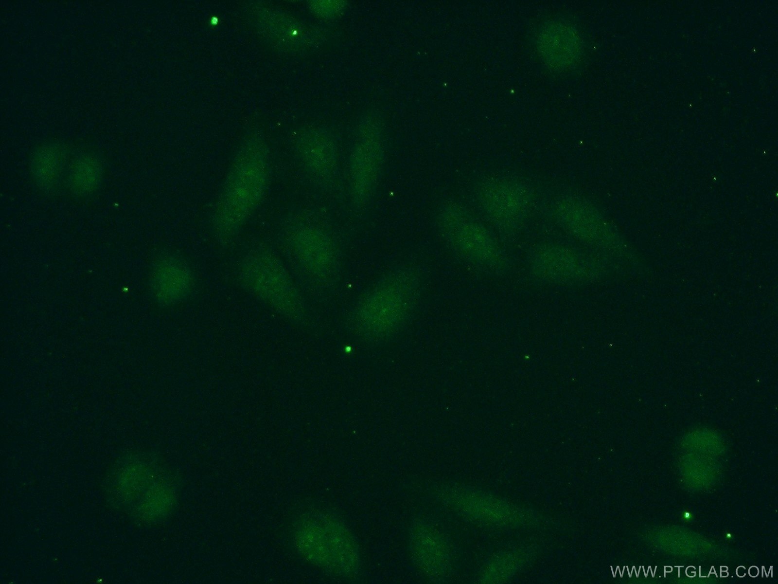 IF Staining of HepG2 using 16678-1-AP