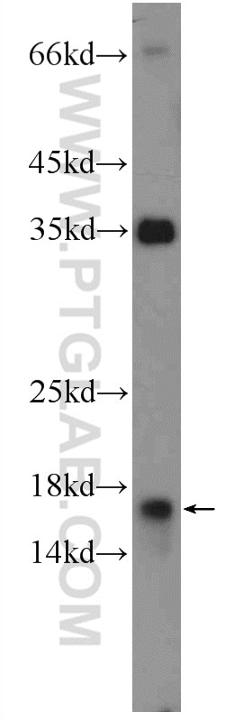 Western Blot (WB) analysis of HepG2 cells using POLR1D Polyclonal antibody (16678-1-AP)