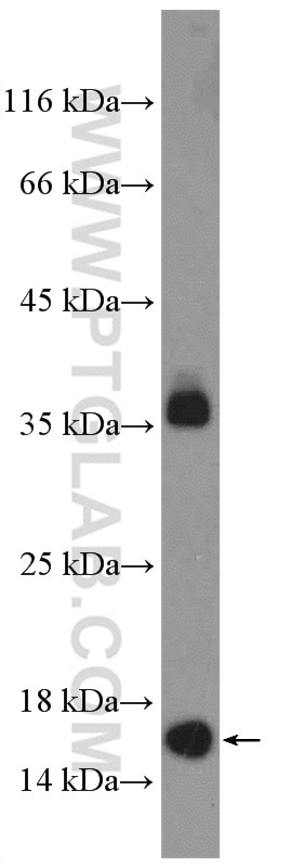 Western Blot (WB) analysis of HeLa cells using POLR1D Polyclonal antibody (16678-1-AP)