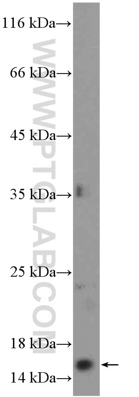 Western Blot (WB) analysis of Jurkat cells using POLR1D Polyclonal antibody (16678-1-AP)