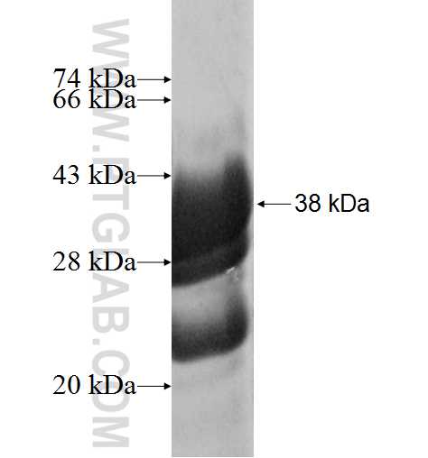 POLR1D fusion protein Ag2904 SDS-PAGE