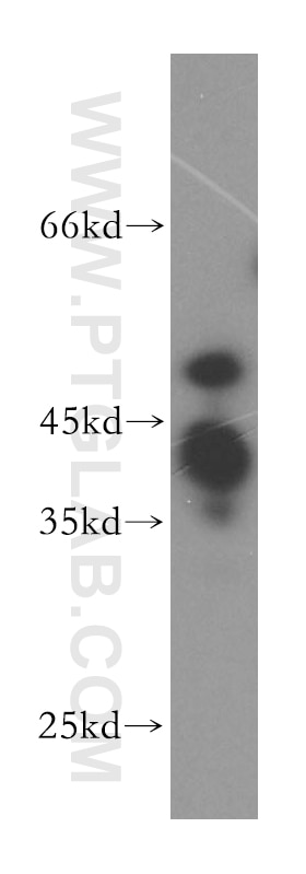 Western Blot (WB) analysis of human brain tissue using POLR1E Polyclonal antibody (16145-1-AP)