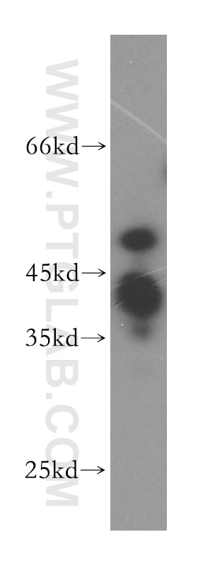 WB analysis of human brain using 16145-1-AP