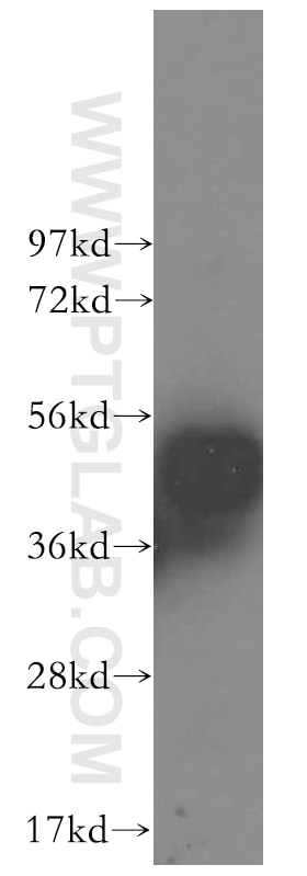 Western Blot (WB) analysis of Jurkat cells using POLR1E Polyclonal antibody (16145-1-AP)
