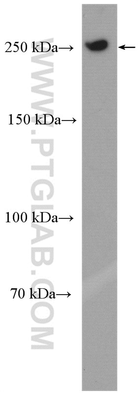 Western Blot (WB) analysis of HeLa cells using POLR2A Polyclonal antibody (20655-1-AP)