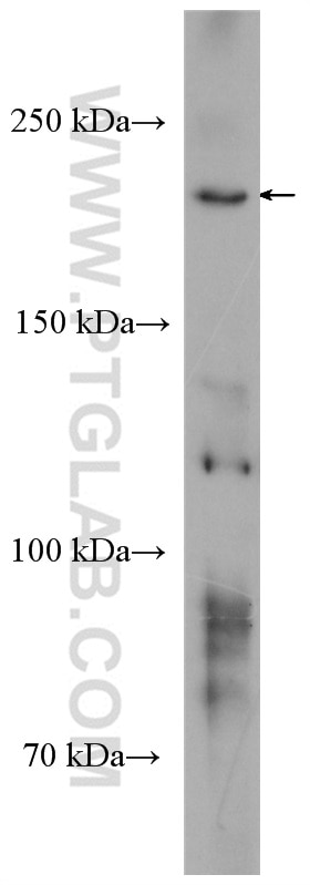 Western Blot (WB) analysis of A431 cells using POLR2A Polyclonal antibody (20655-1-AP)