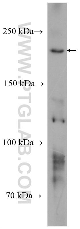 WB analysis of A431 using 20655-1-AP