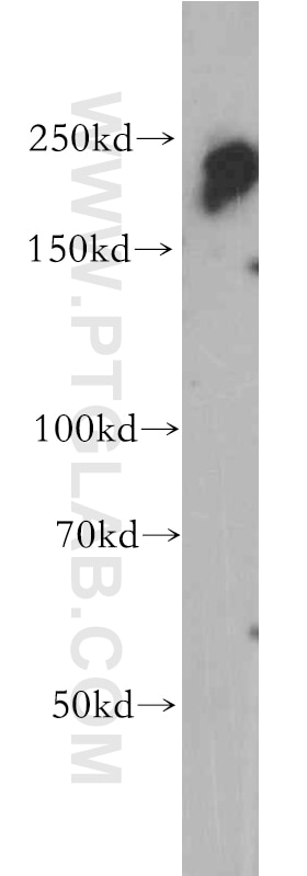 Western Blot (WB) analysis of HepG2 cells using POLR2A Polyclonal antibody (20655-1-AP)