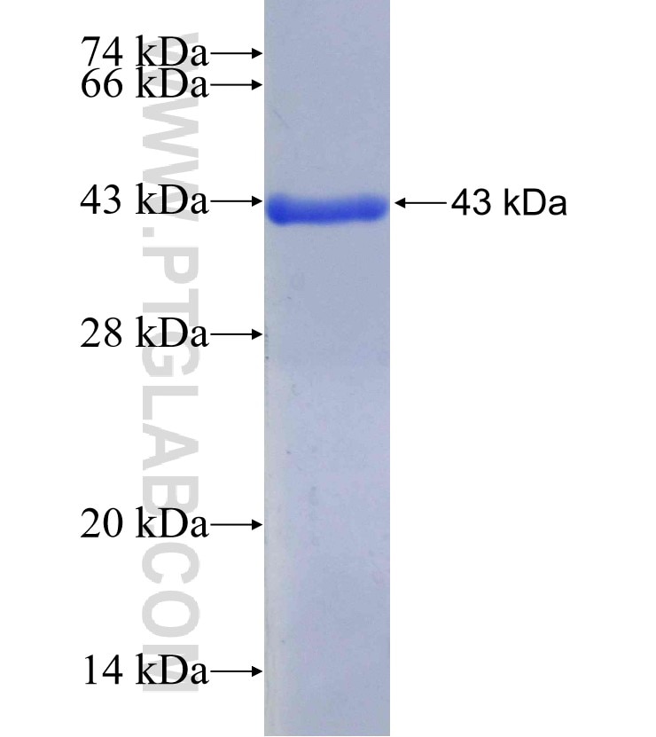 POLR2A fusion protein Ag29422 SDS-PAGE POLR2A fusion protein Ag29422 SDS-PAGE