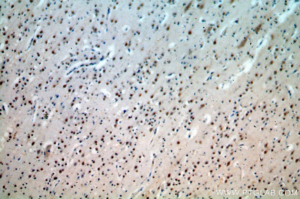 Immunohistochemistry (IHC) staining of human brain tissue using POLR2B-Specific Polyclonal antibody (20370-1-AP)