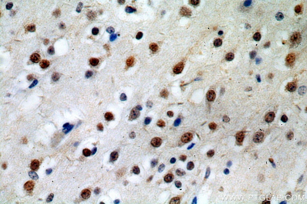 Immunohistochemistry (IHC) staining of human brain tissue using POLR2B-Specific Polyclonal antibody (20370-1-AP)