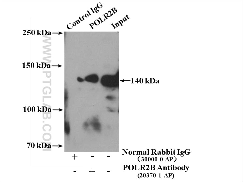 Immunoprecipitation (IP) experiment of HeLa cells using POLR2B-Specific Polyclonal antibody (20370-1-AP)