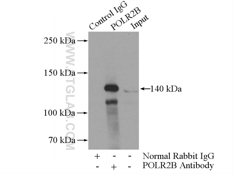 Immunoprecipitation (IP) experiment of HeLa cells using POLR2B-Specific Polyclonal antibody (20370-1-AP)
