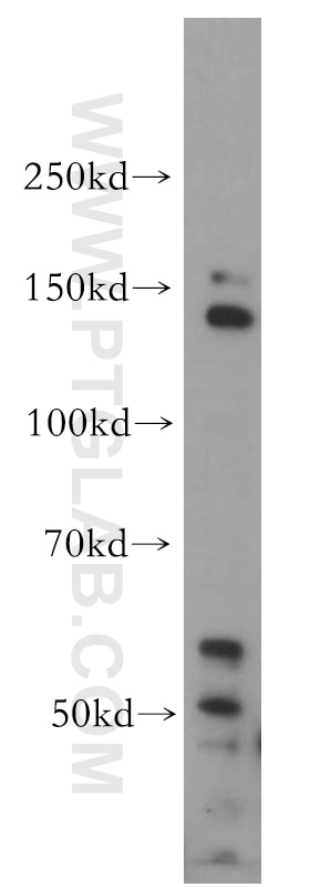 Western Blot (WB) analysis of HeLa cells using POLR2B-Specific Polyclonal antibody (20370-1-AP)