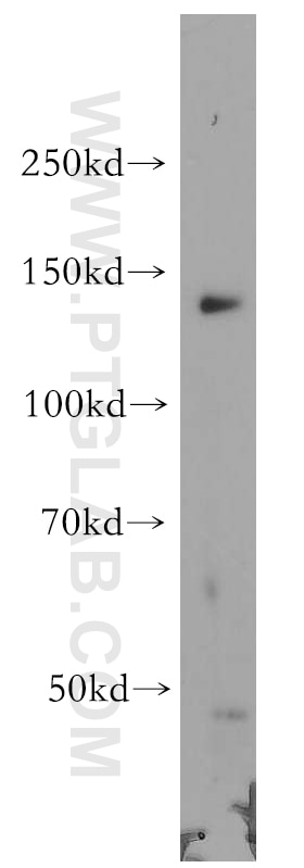 Western Blot (WB) analysis of A431 cells using POLR2B-Specific Polyclonal antibody (20370-1-AP)