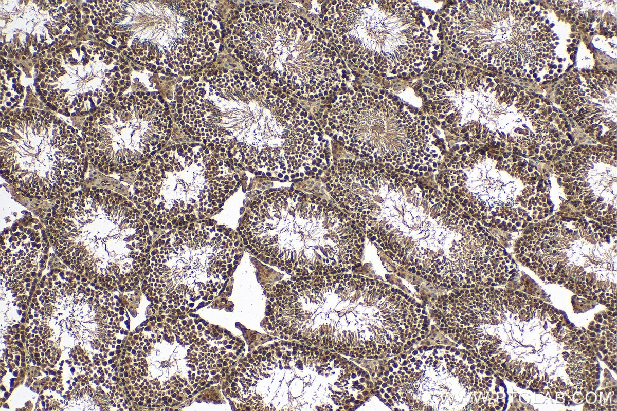 Immunohistochemistry (IHC) staining of mouse testis tissue using POLR2D Polyclonal antibody (16093-1-AP)