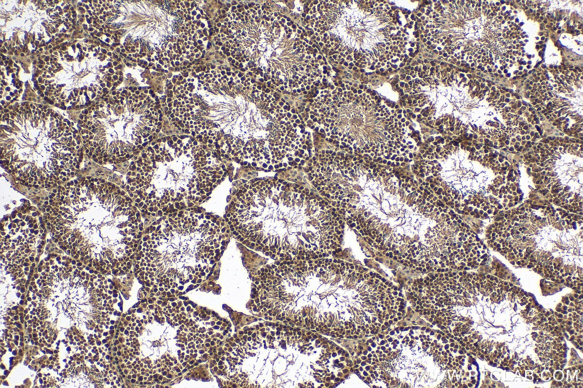 IHC staining of mouse testis using 16093-1-AP