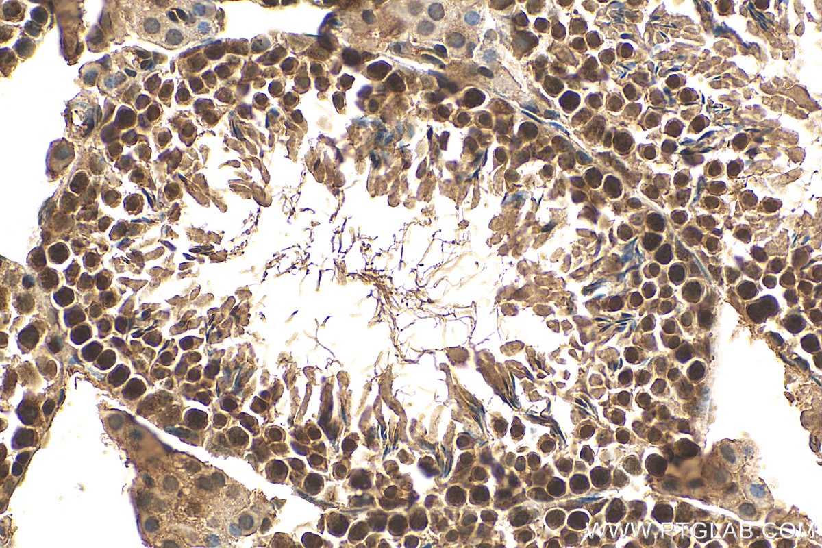 Immunohistochemistry (IHC) staining of mouse testis tissue using POLR2D Polyclonal antibody (16093-1-AP)