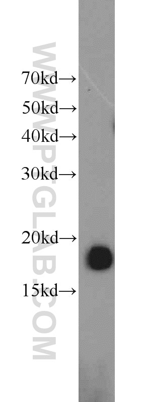 Western Blot (WB) analysis of rat skeletal muscle tissue using POLR2D Polyclonal antibody (16093-1-AP)