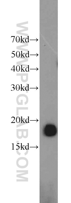 Western Blot (WB) analysis of rat skeletal muscle tissue using POLR2D Polyclonal antibody (16093-1-AP)