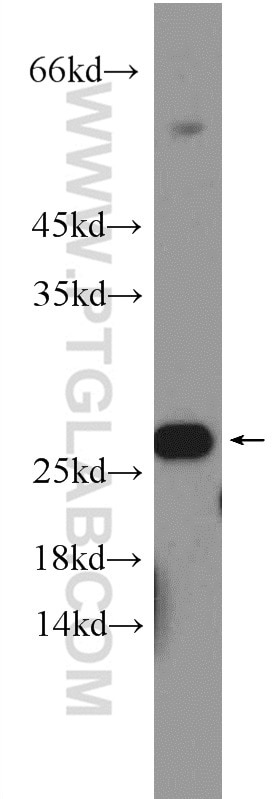 Western Blot (WB) analysis of rat liver tissue using RPB5 Polyclonal antibody (15217-1-AP)