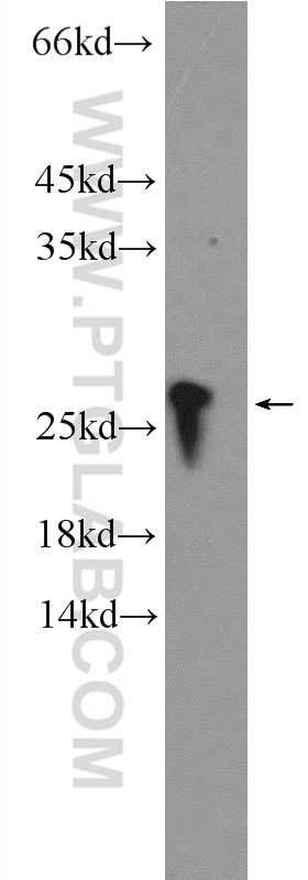 Western Blot (WB) analysis of rat spleen tissue using RPB5 Polyclonal antibody (15217-1-AP)