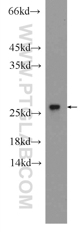 Western Blot (WB) analysis of mouse spleen tissue using RPB5 Polyclonal antibody (15217-1-AP)