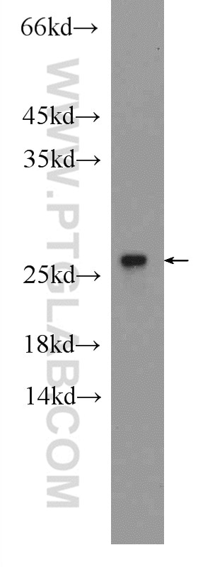 WB analysis of mouse spleen using 15217-1-AP