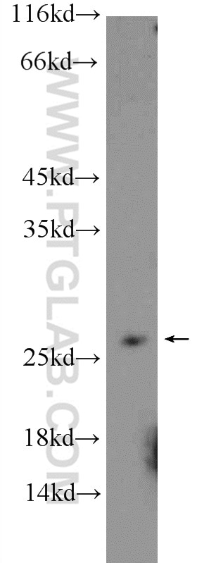 Western Blot (WB) analysis of mouse liver tissue using RPB5 Polyclonal antibody (15217-1-AP)