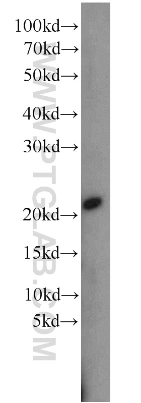 Western Blot (WB) analysis of HeLa cells using RPB5 Polyclonal antibody (15217-1-AP)