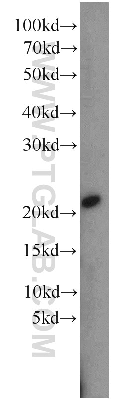 WB analysis of HeLa using 15217-1-AP