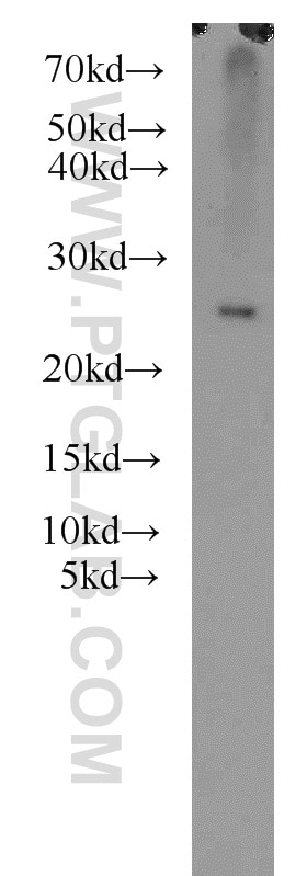 Western Blot (WB) analysis of MCF-7 cells using RPB5 Polyclonal antibody (15217-1-AP)