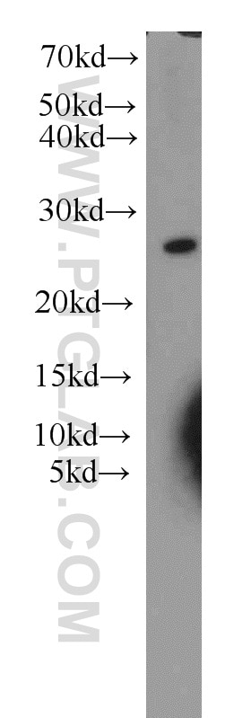 Western Blot (WB) analysis of A549 cells using RPB5 Polyclonal antibody (15217-1-AP)