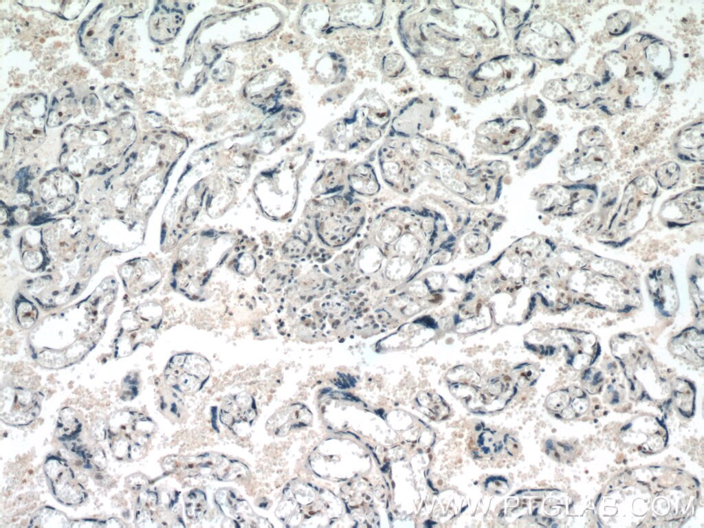 Immunohistochemistry (IHC) staining of human placenta tissue using POLR2F Polyclonal antibody (15334-1-AP)