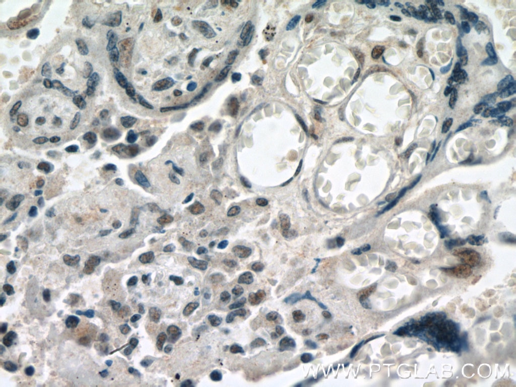 Immunohistochemistry (IHC) staining of human placenta tissue using POLR2F Polyclonal antibody (15334-1-AP)