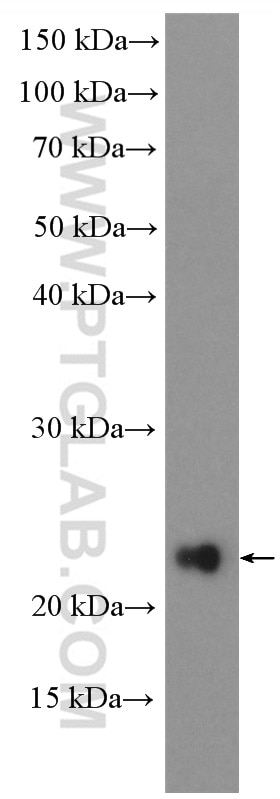 Western Blot (WB) analysis of A375 cells using POLR2G Polyclonal antibody (18497-1-AP)