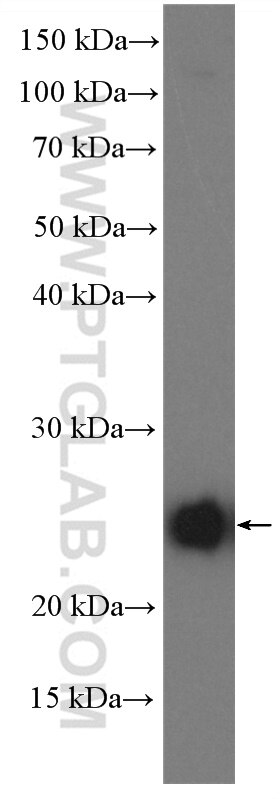 Western Blot (WB) analysis of A431 cells using POLR2G Polyclonal antibody (18497-1-AP)