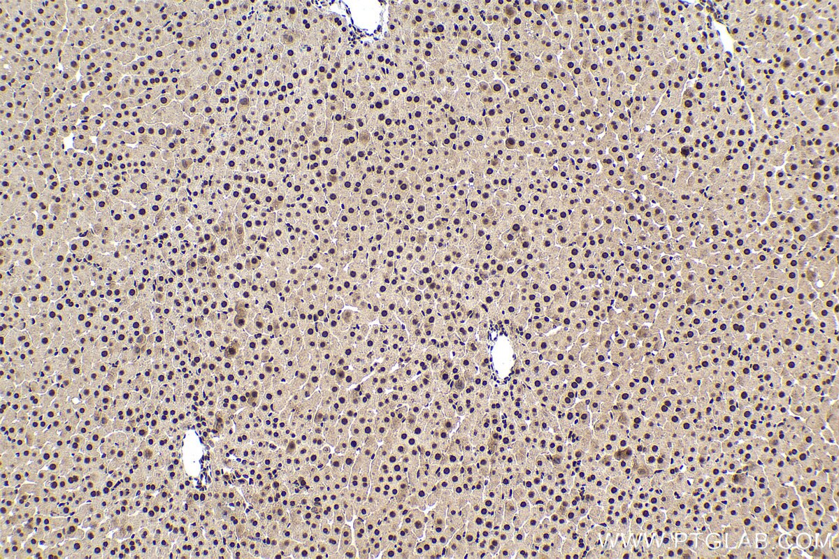 IHC staining of rat liver using 17270-1-AP