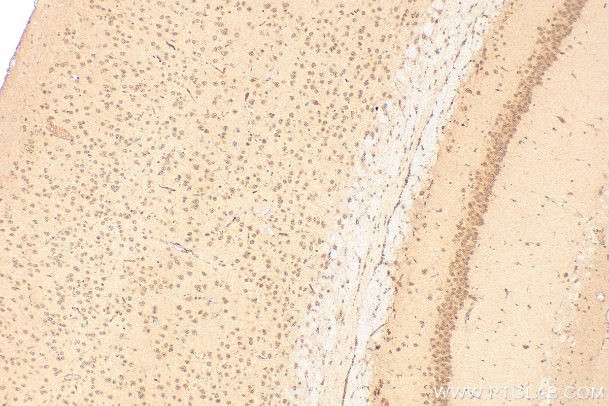 Immunohistochemistry (IHC) staining of mouse brain tissue using POLR2I Polyclonal antibody (17270-1-AP)