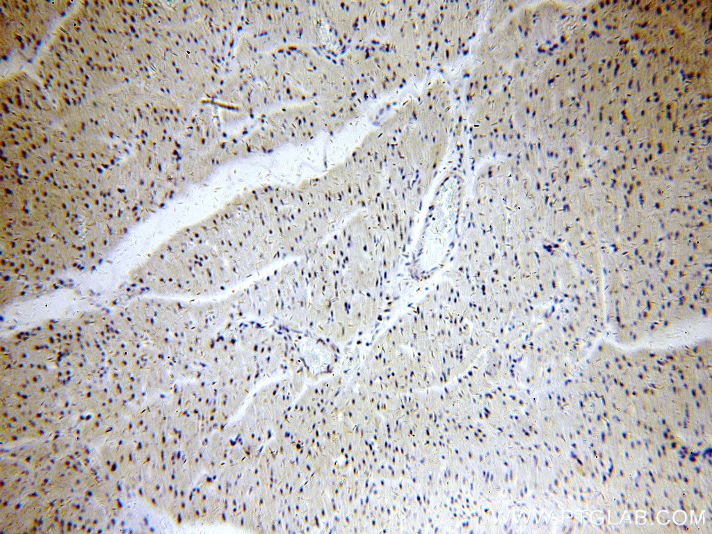 Immunohistochemistry (IHC) staining of human heart tissue using POLR2J Polyclonal antibody (16403-1-AP)