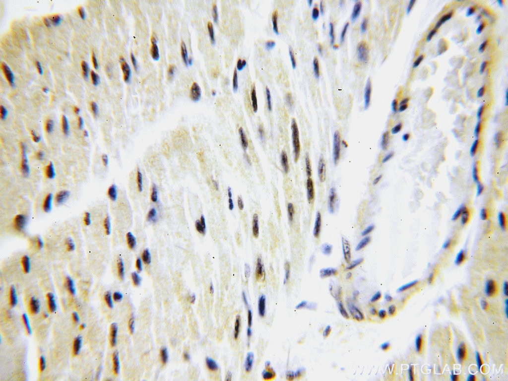 IHC staining of human heart using 16403-1-AP