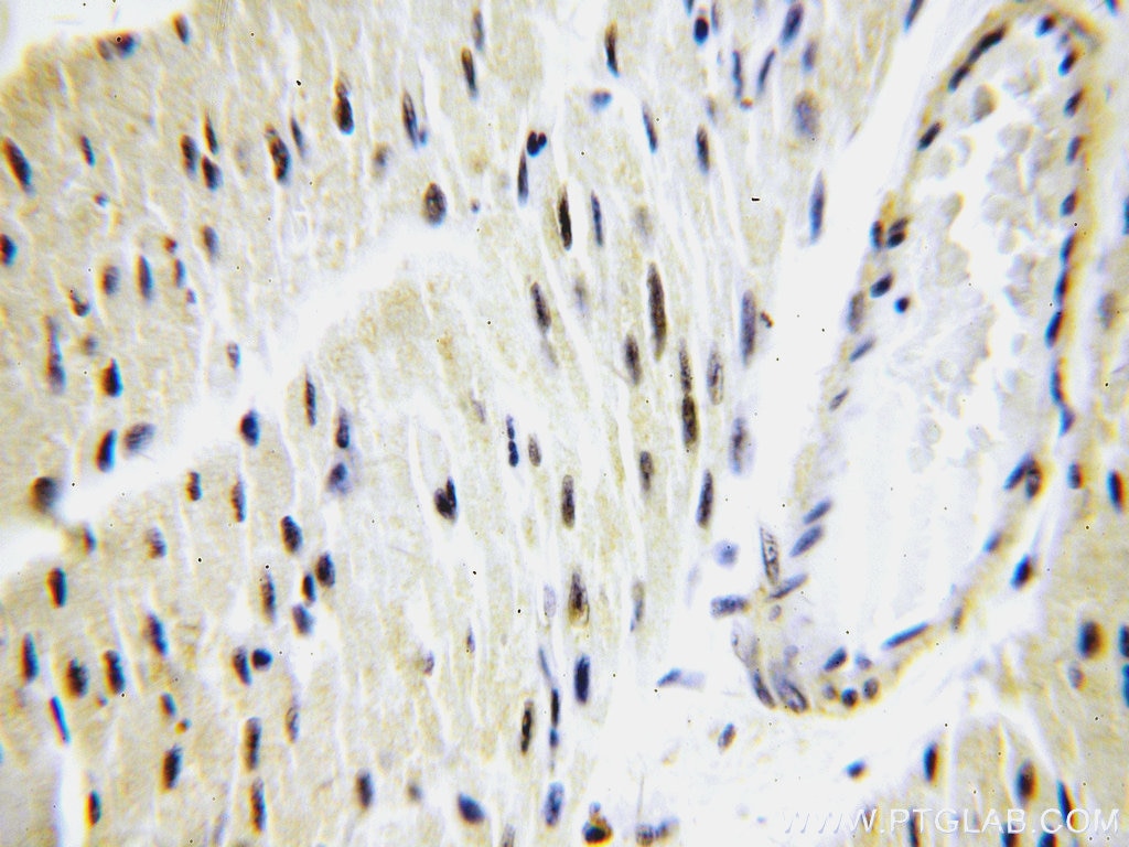 Immunohistochemistry (IHC) staining of human heart tissue using POLR2J Polyclonal antibody (16403-1-AP)