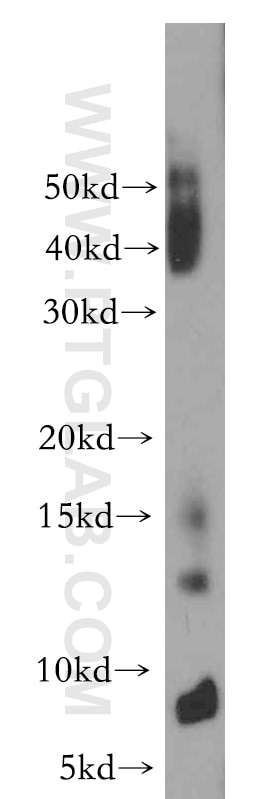 Western Blot (WB) analysis of A549 cells using POLR2J Polyclonal antibody (16403-1-AP)