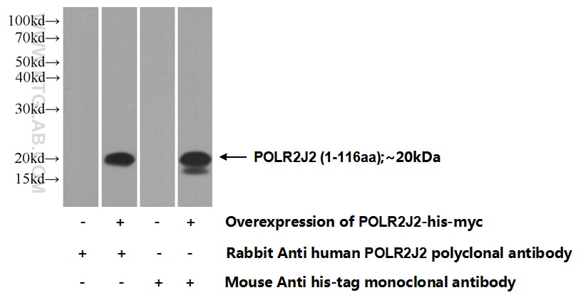 Western Blot (WB) analysis of Transfected HEK-293 cells using POLR2J2 Polyclonal antibody (25932-1-AP)