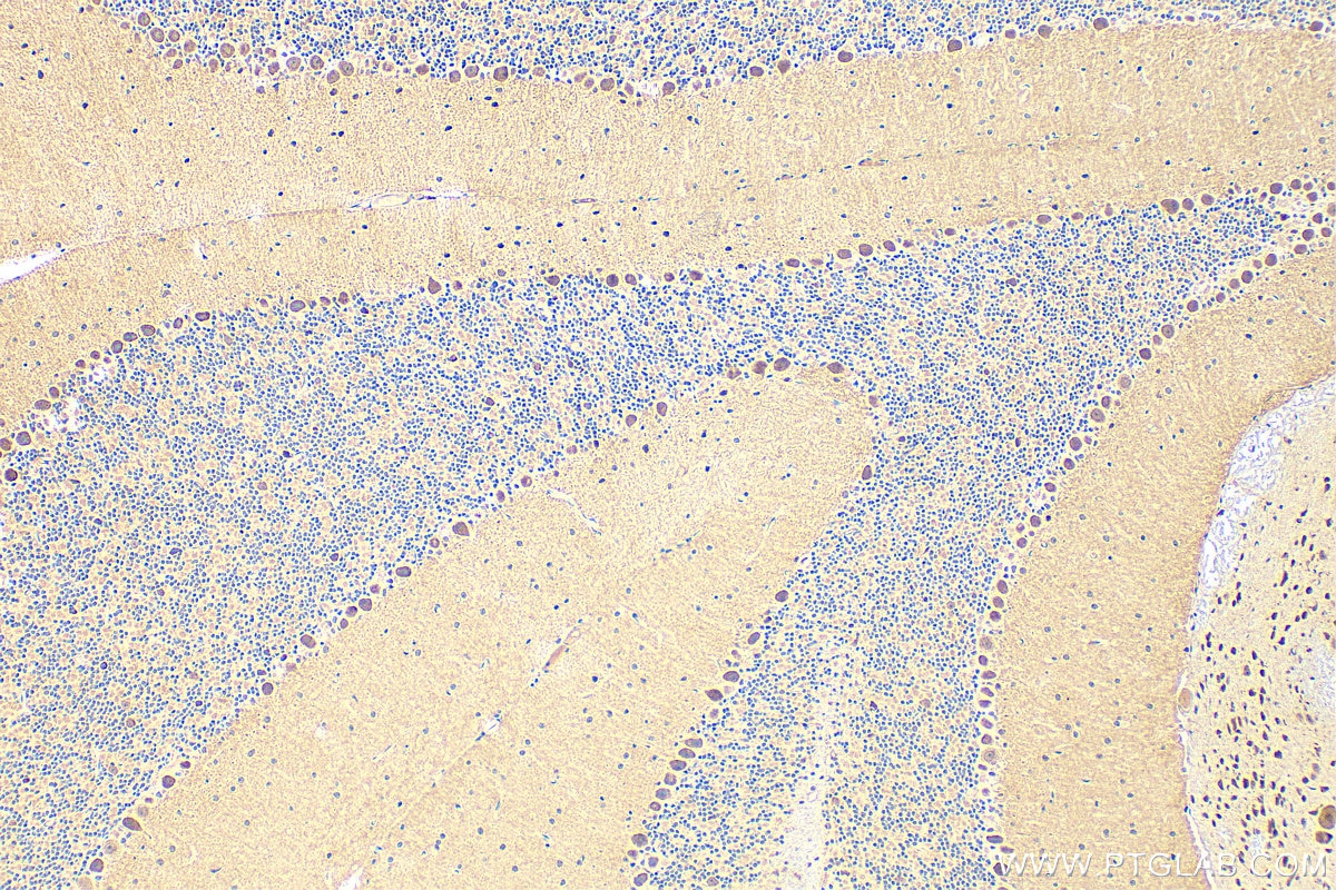 Immunohistochemistry (IHC) staining of mouse cerebellum tissue using POLR3A Polyclonal antibody (17530-1-AP)
