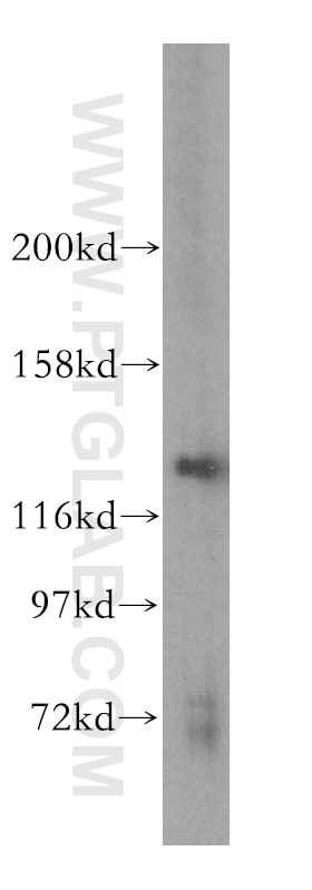 Western Blot (WB) analysis of HepG2 cells using POLR3B Polyclonal antibody (16574-1-AP)